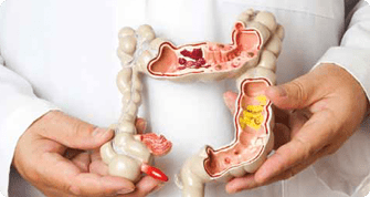 colorectal diseases & procedure pic