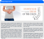 diverticular disease of the colon thumbnail